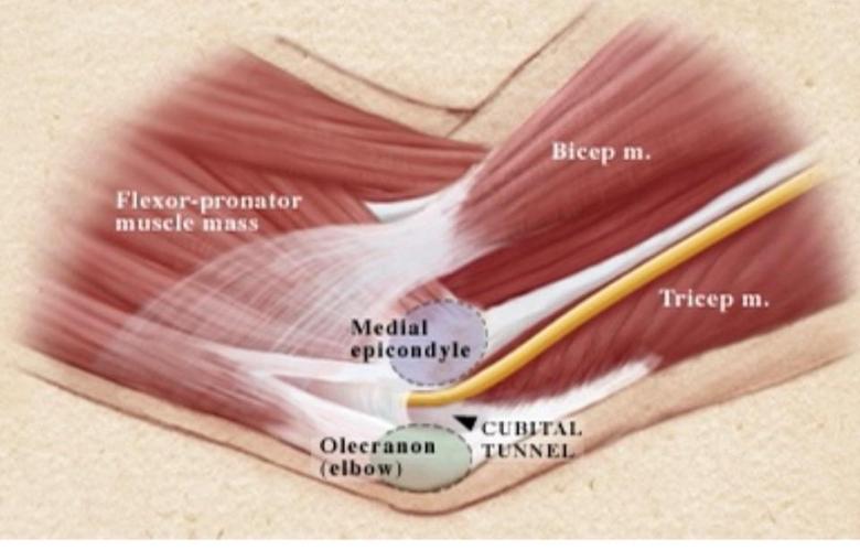 爱煲电话粥当心手机肘