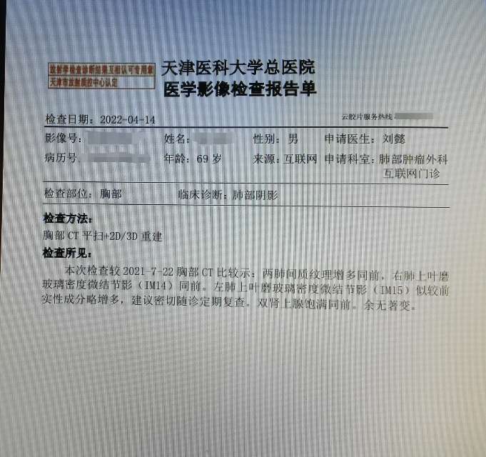 刘懿博士说肺癌(三八四一)间隔一个月,新增一厘米肺磨玻璃结节 - 微医