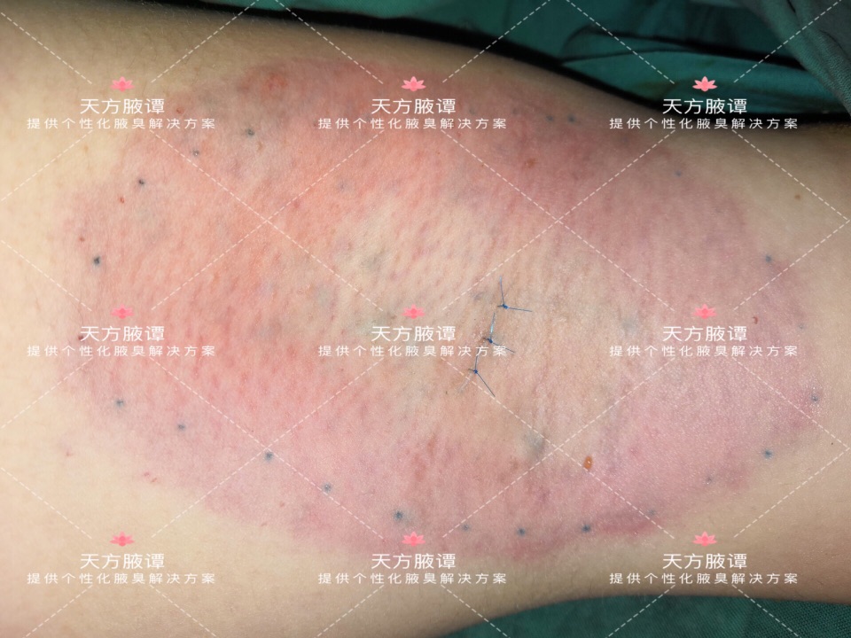 【一千零一腋】之835