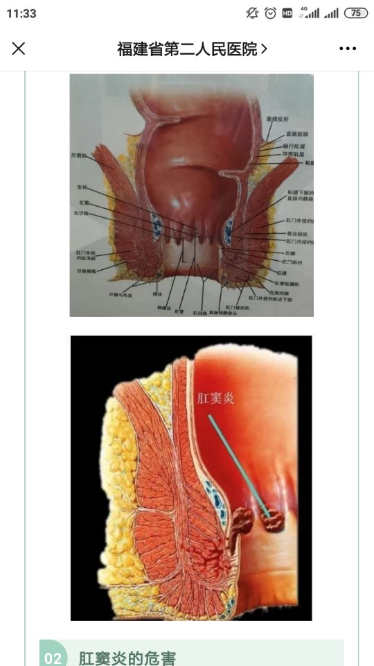 健康科普令人烦恼的肛窦炎