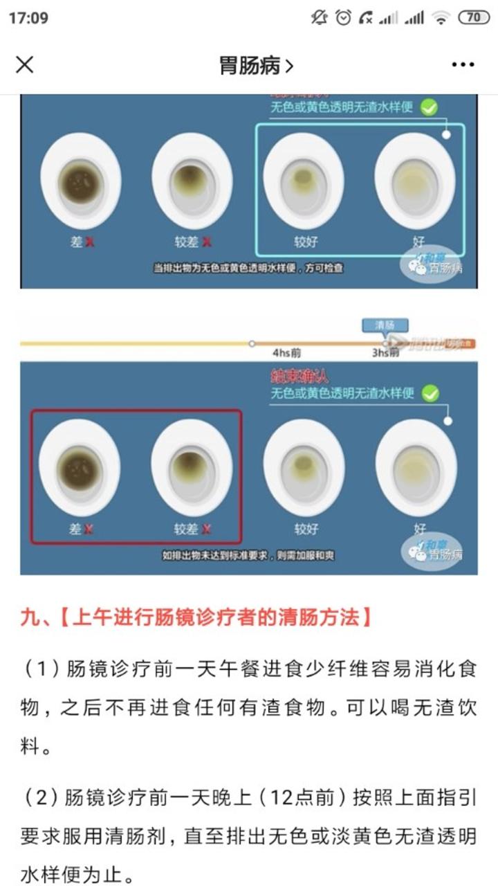 腸鏡檢查如何有效清腸這還真是個技術活