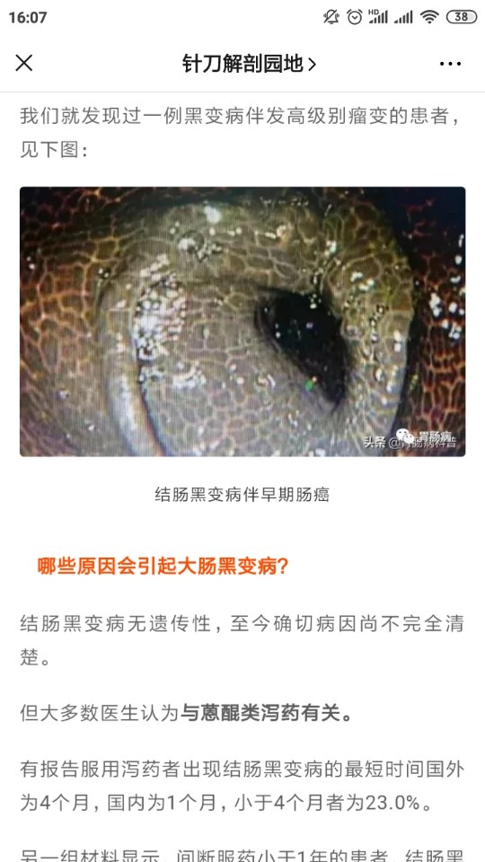 带您认识结肠黑肠病中