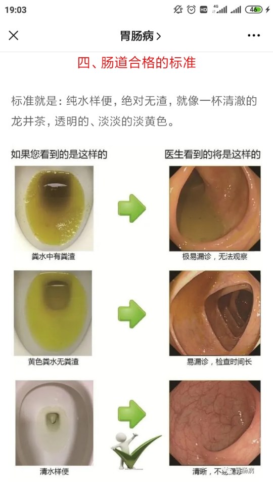 肠镜6张图片对应部位图片