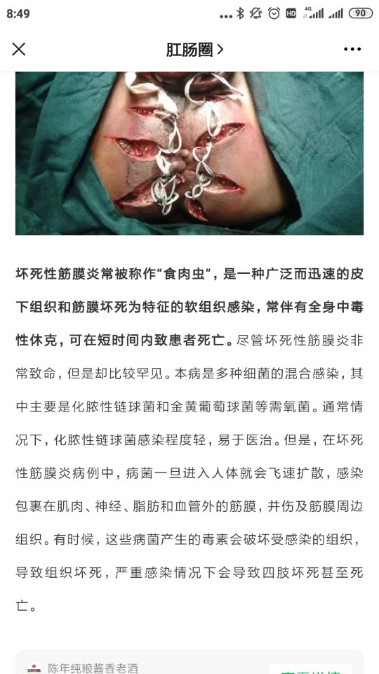 突发坏死性筋膜炎知名音乐人乘机身亡