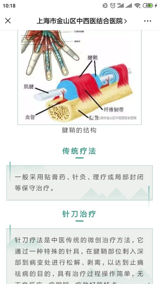 小针刀解决大困扰之腱鞘炎的针刀治疗
