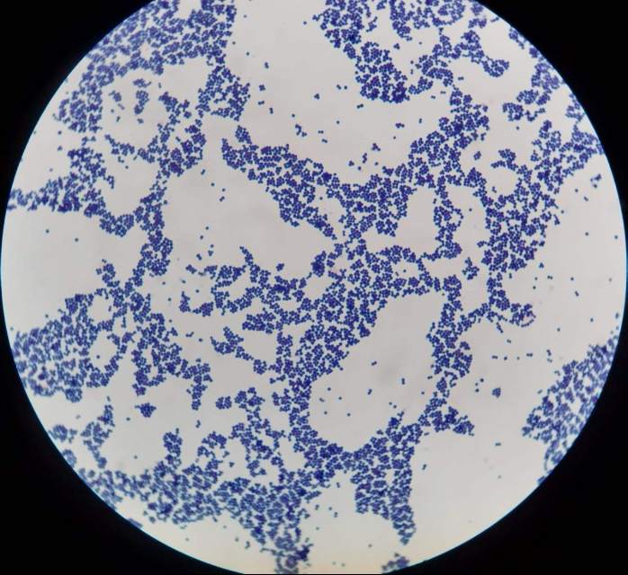 显微镜下的球菌图片