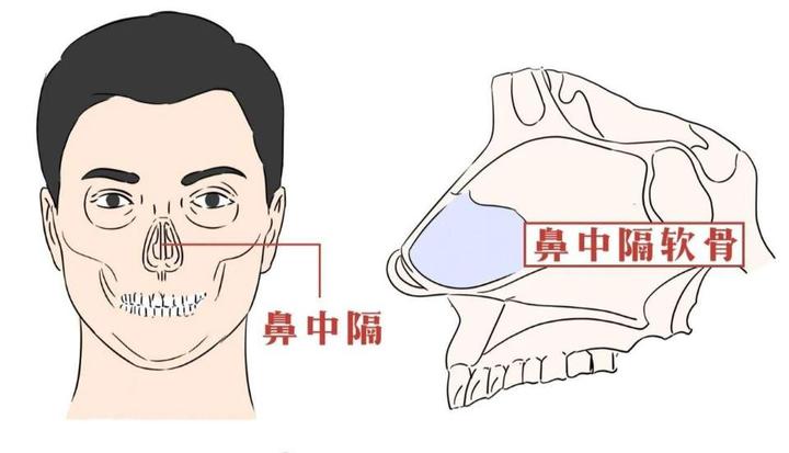 在同一手术切口进行鼻中隔取出术和鼻小柱延长术,人体总创口面积减小.