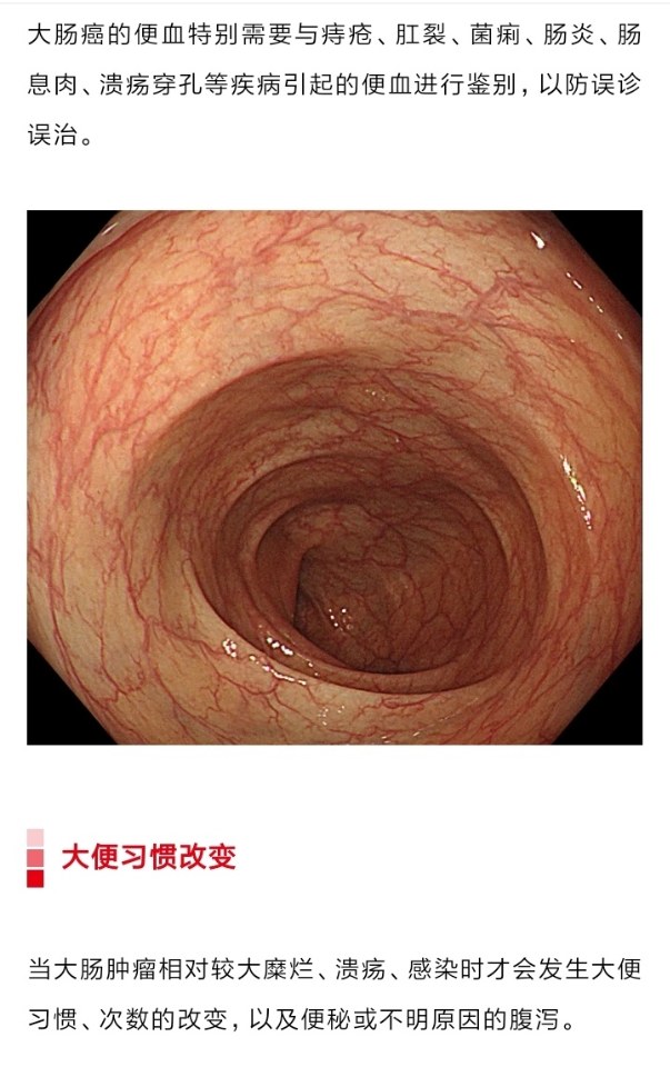 肠镜检查图图片