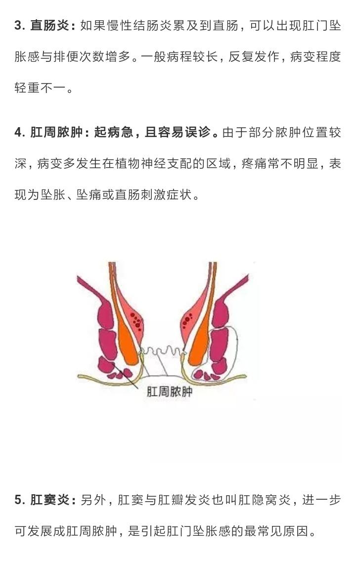 肛门坠胀排便不尽莫轻视引发症状的元凶可能是他们