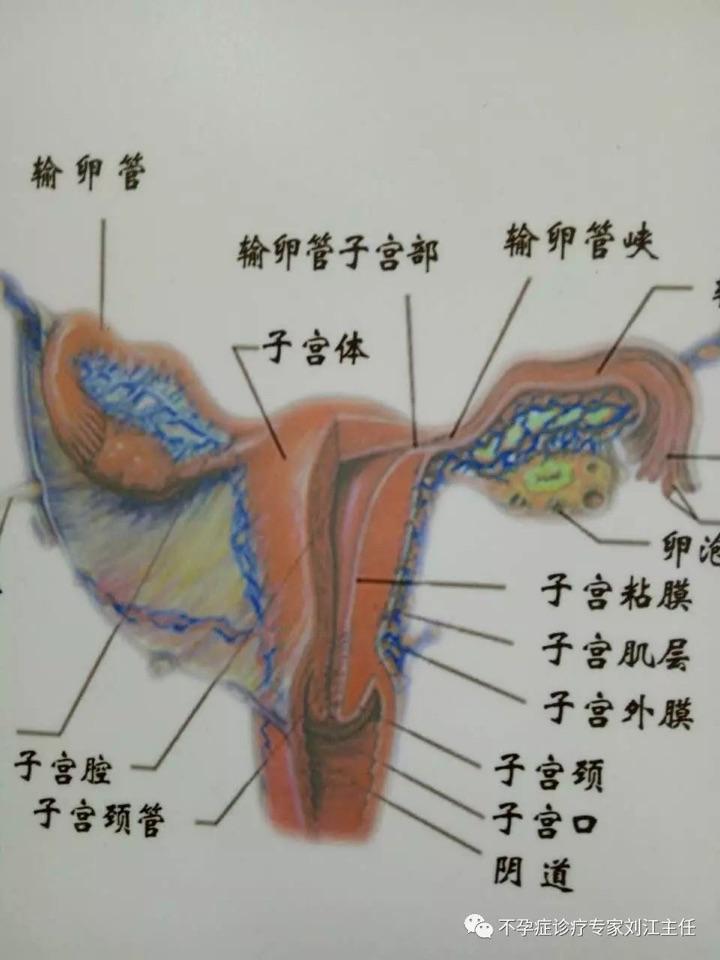 術中查看:面對該患者左側輸卵管無功能(不能懷孕),如果這次宮外孕手術