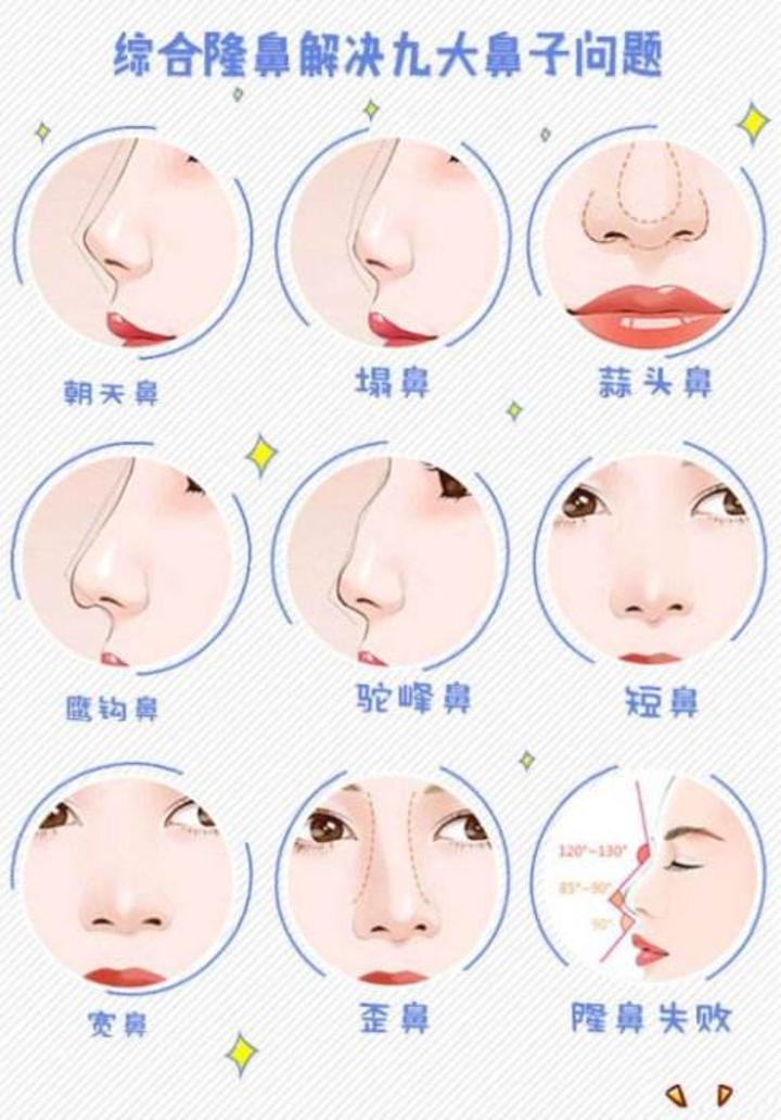 99圆头鼻鹰钩鼻是指鼻梁中间部分过度凸出的鼻子,同样会给人凶狠的