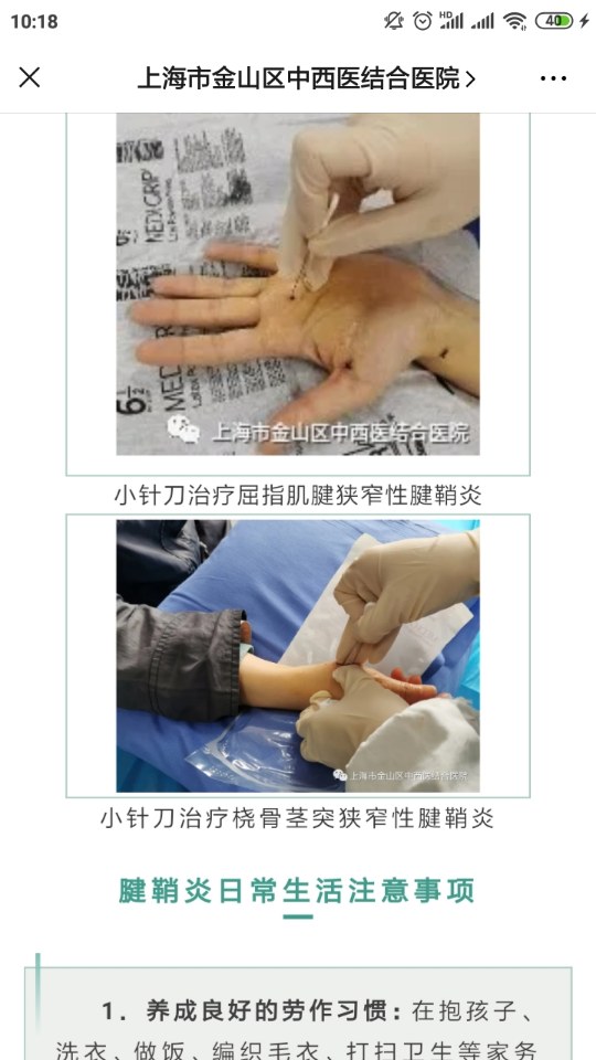 郭民庆针刀治疗女性图片