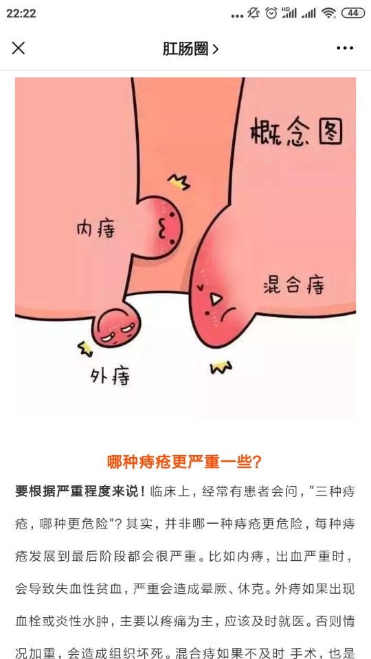 陈年老痔疮到底要不要根治iii度内痔药物治疗iiiiv度内痔建议及早手术