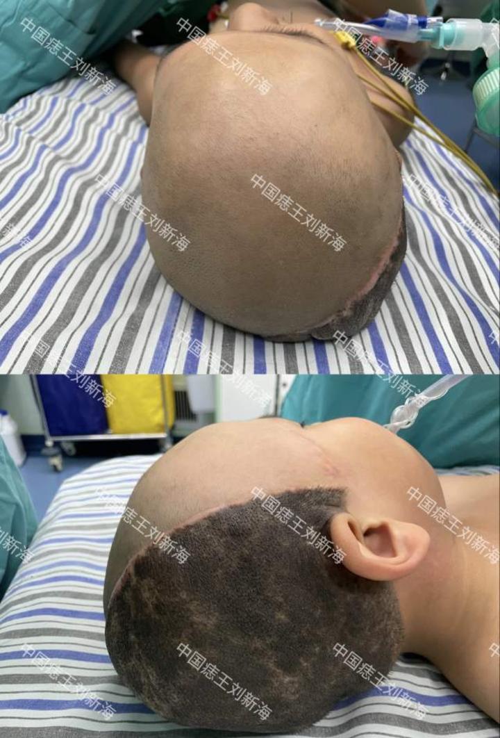 头面部巨痣 - 微医(挂号网)