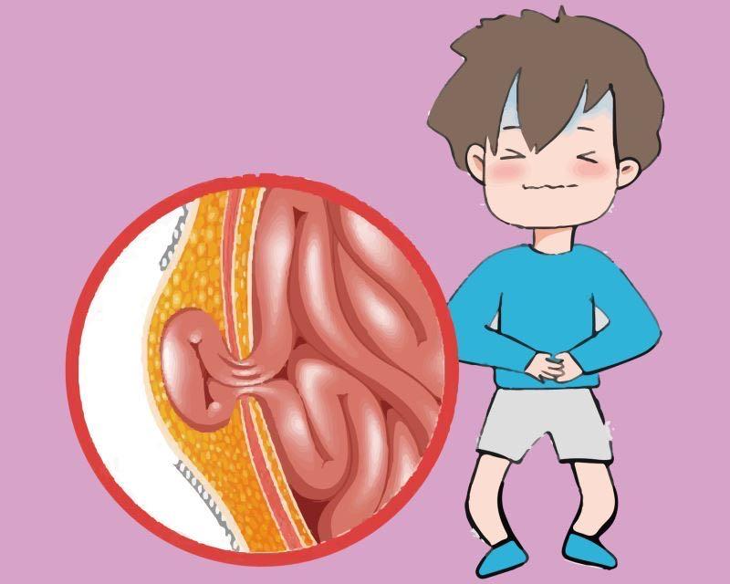疝气带卡通图片