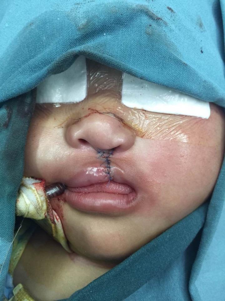 金蕾职称:主治医师医院:上海市儿童医院北京西.