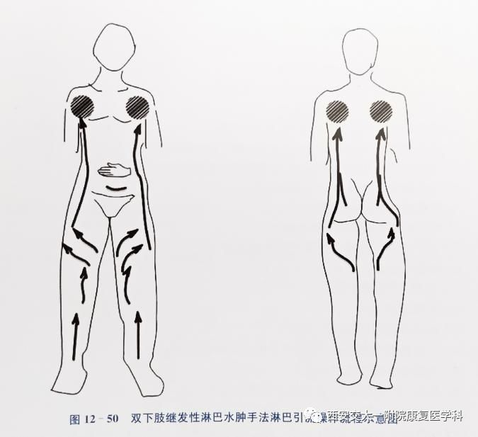 淋巴水腫患者居家康復科普系列一下肢自我引流