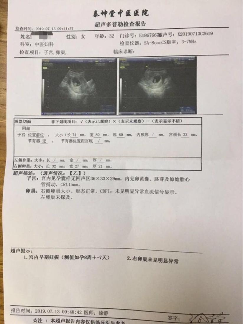 多囊卵巢综合征十余年原发不孕2年治疗2月怀孕病案 健康号 微医