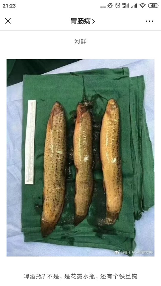 直肠不直进去容易出来难盘点那些匪夷所思的直肠异物上