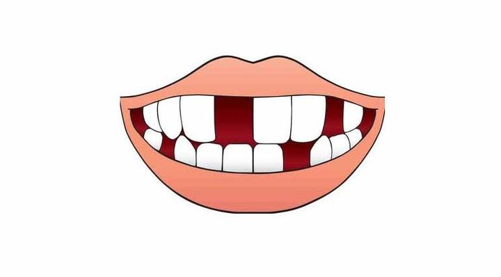 缺牙不镶可以吗? - 微医(挂号网)