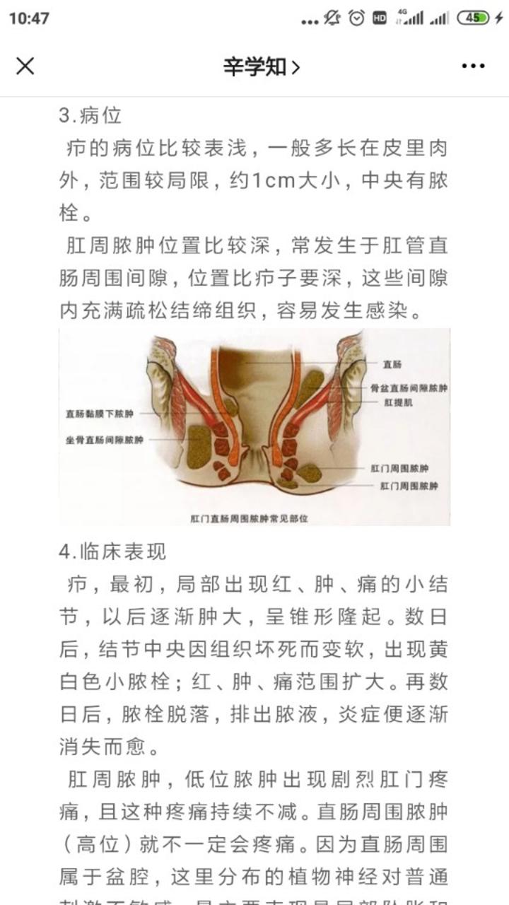 肛周脓肿和疖子如何区分