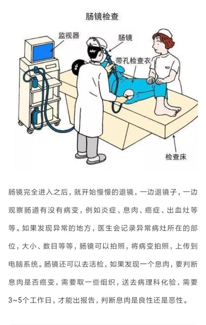肠镜不是人人都能做的.做肠镜应该注意哪些事情? - 微医(挂号网)