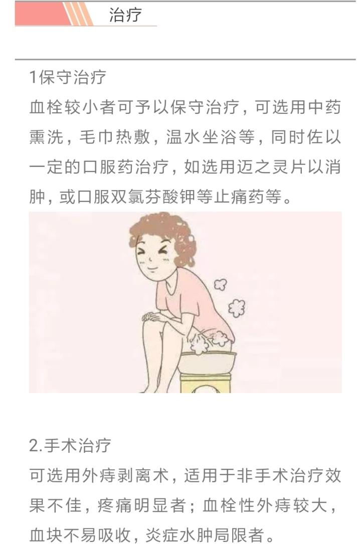 痔病课堂之血栓性外痔