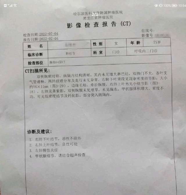 肺部良性肿瘤ct报告图片