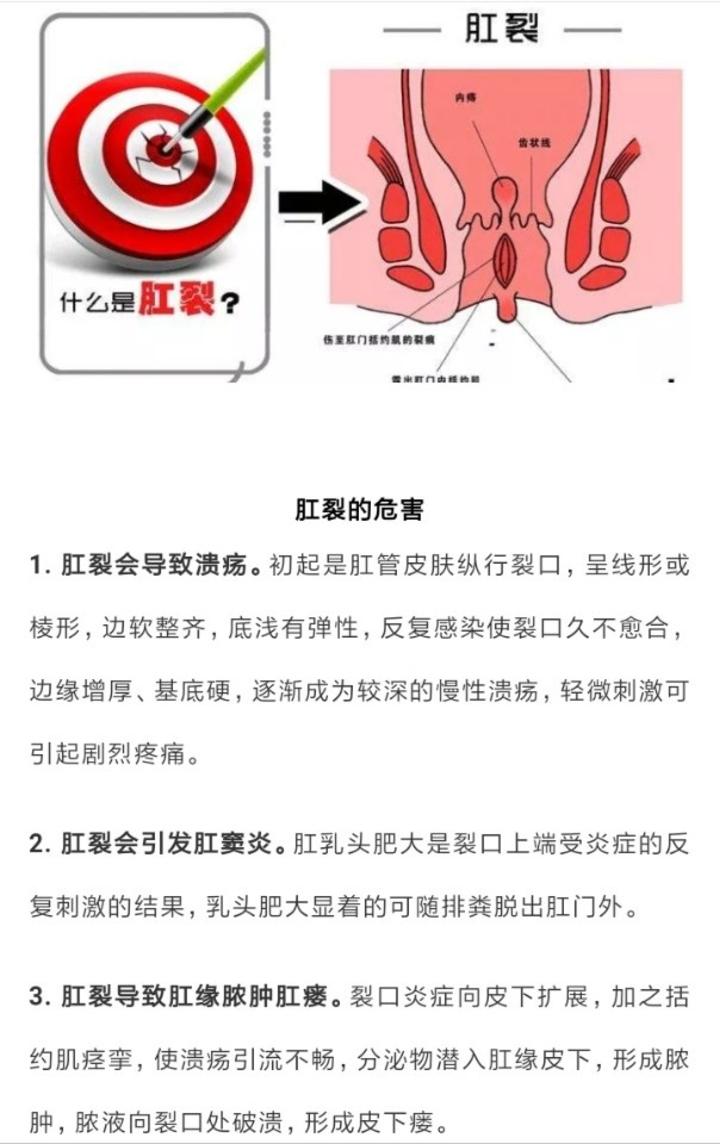 带你认识肛裂有什么危害得了肛裂怎么办