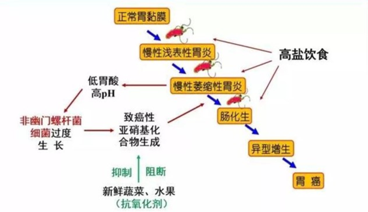 慢性萎缩性胃炎这十大问题你一定要知道