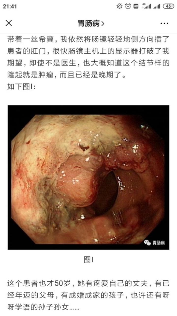 便血半年当痔疮查出肠癌太冤枉医生提醒这5个症状不是痔疮是肠癌