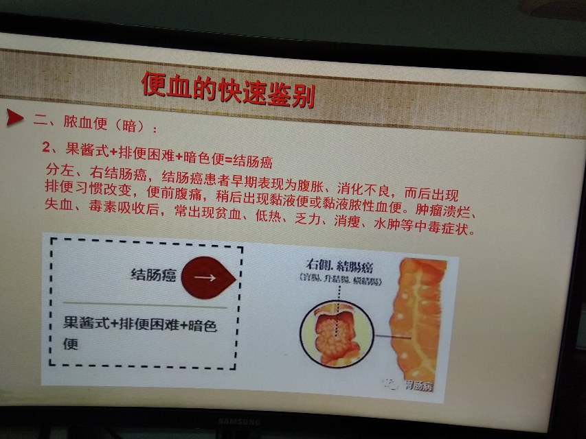 脓血便常见于图片