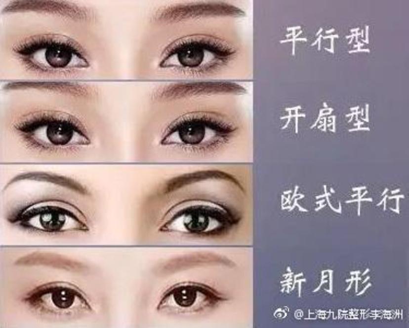 新月型双眼皮与扇形的不同之处就在于其特点是重睑线在内,外眼角距