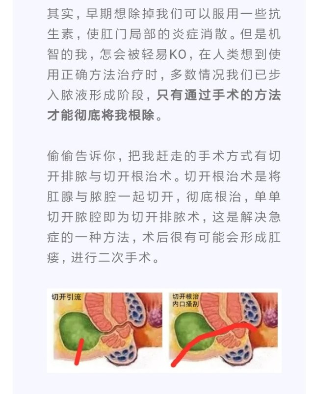 肛周脓肿的真情自白