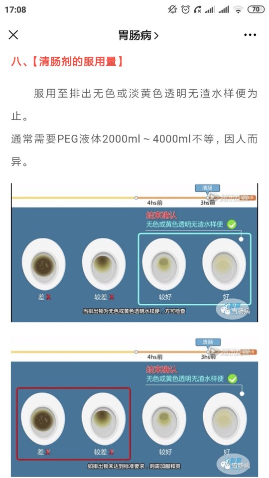 肠镜清肠标准图片