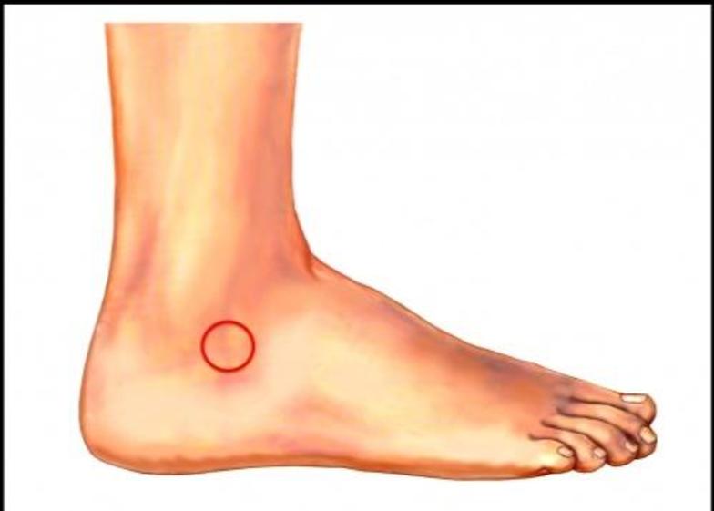 fū)骨窦,为距下关节内略呈锥形的骨性间隙,其内侧为漏斗形的跗骨窦管