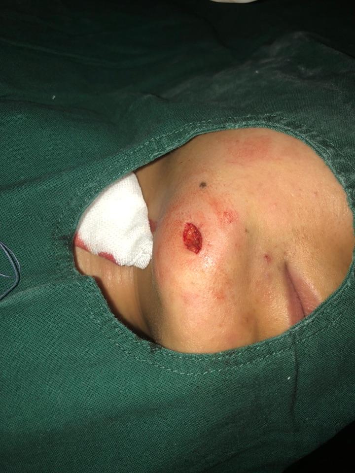 给大家发一组美容手术照片 - 微医(挂号网)