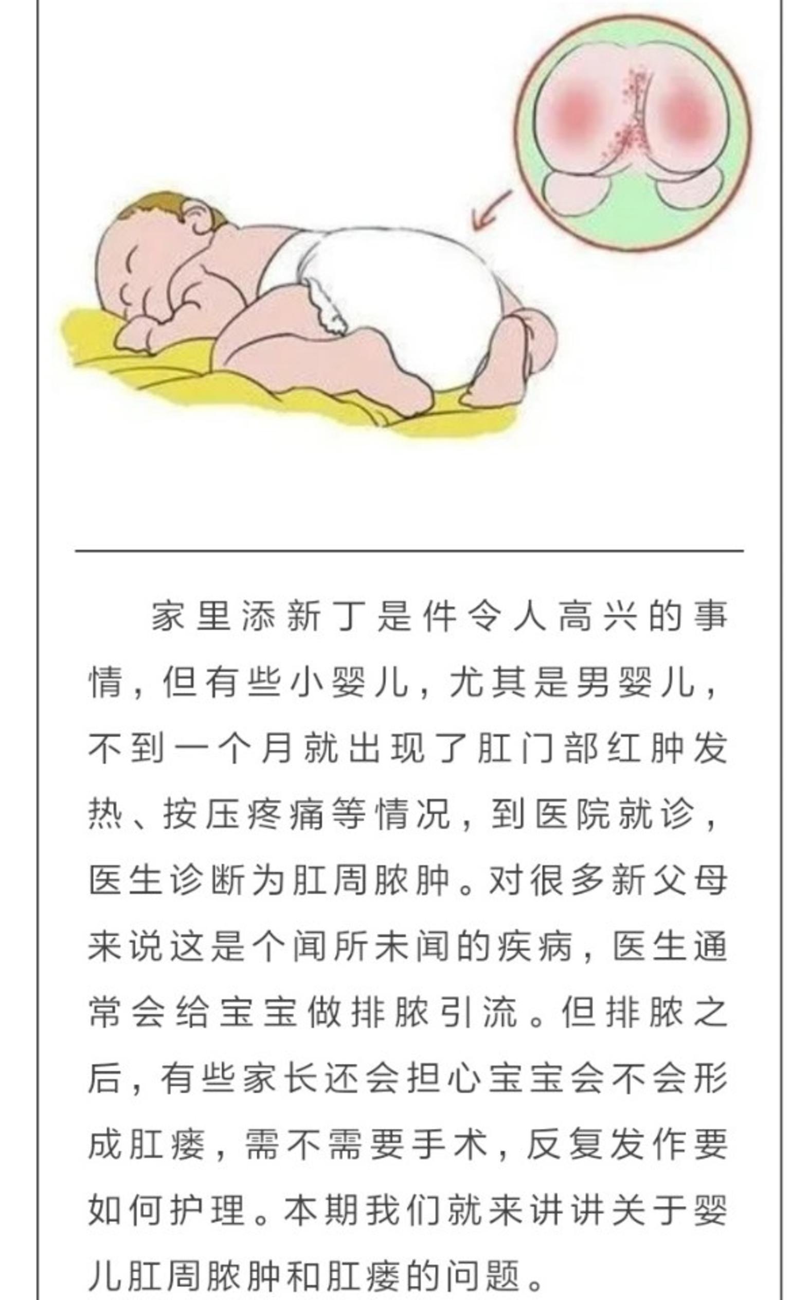 婴儿肛周脓肿要如何处理