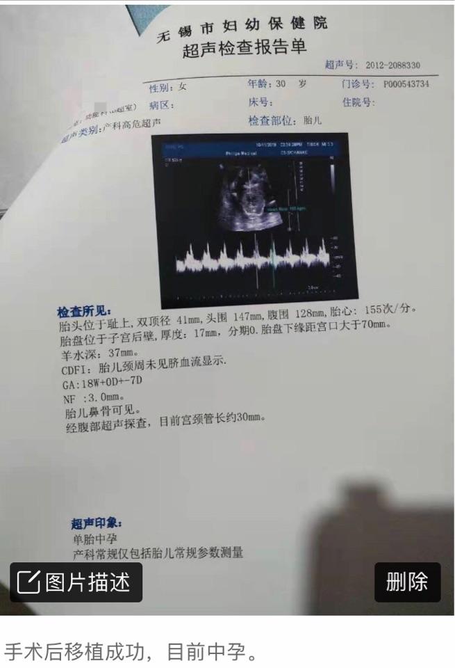 比较常见的有子宫纵隔,单角子宫,双角子宫,鞍状子宫