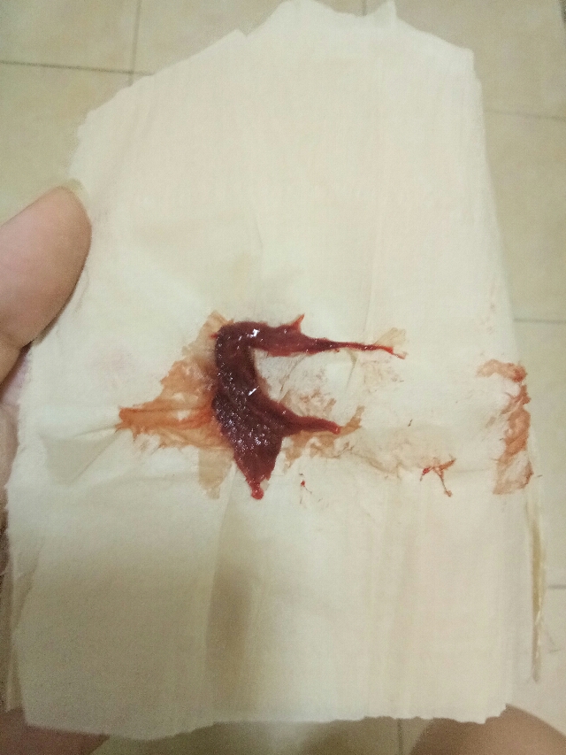 想知道经血中不是血块的块状物是什么