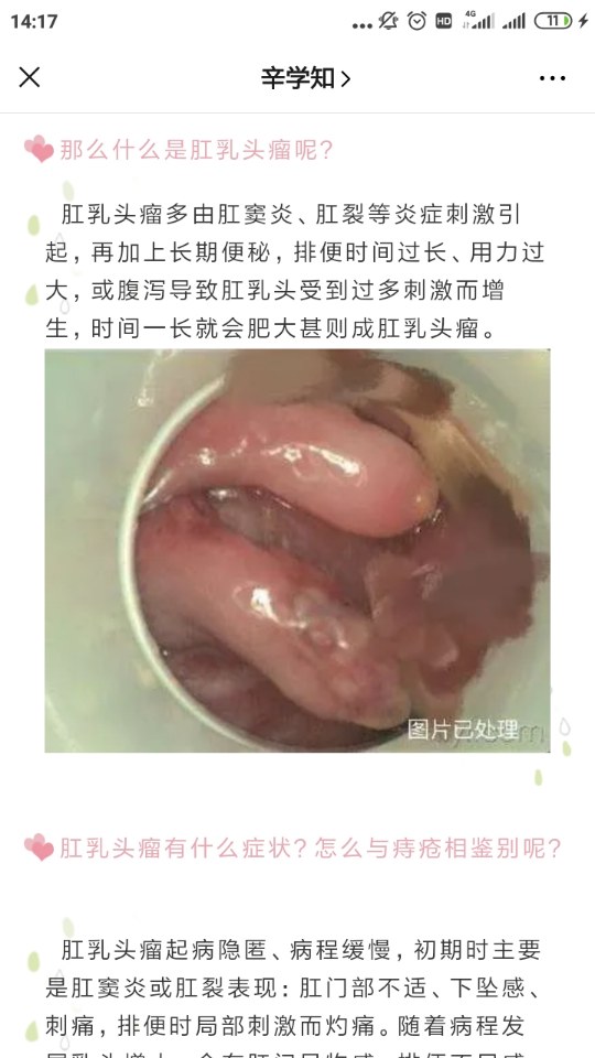 擅长:对肛门直肠良性疾病手术治疗积累了丰富经验,尤其是在