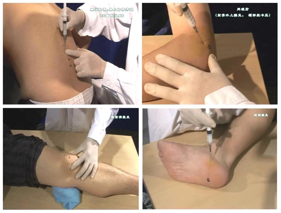 封闭针对颈肩腰腿疼的注射部位