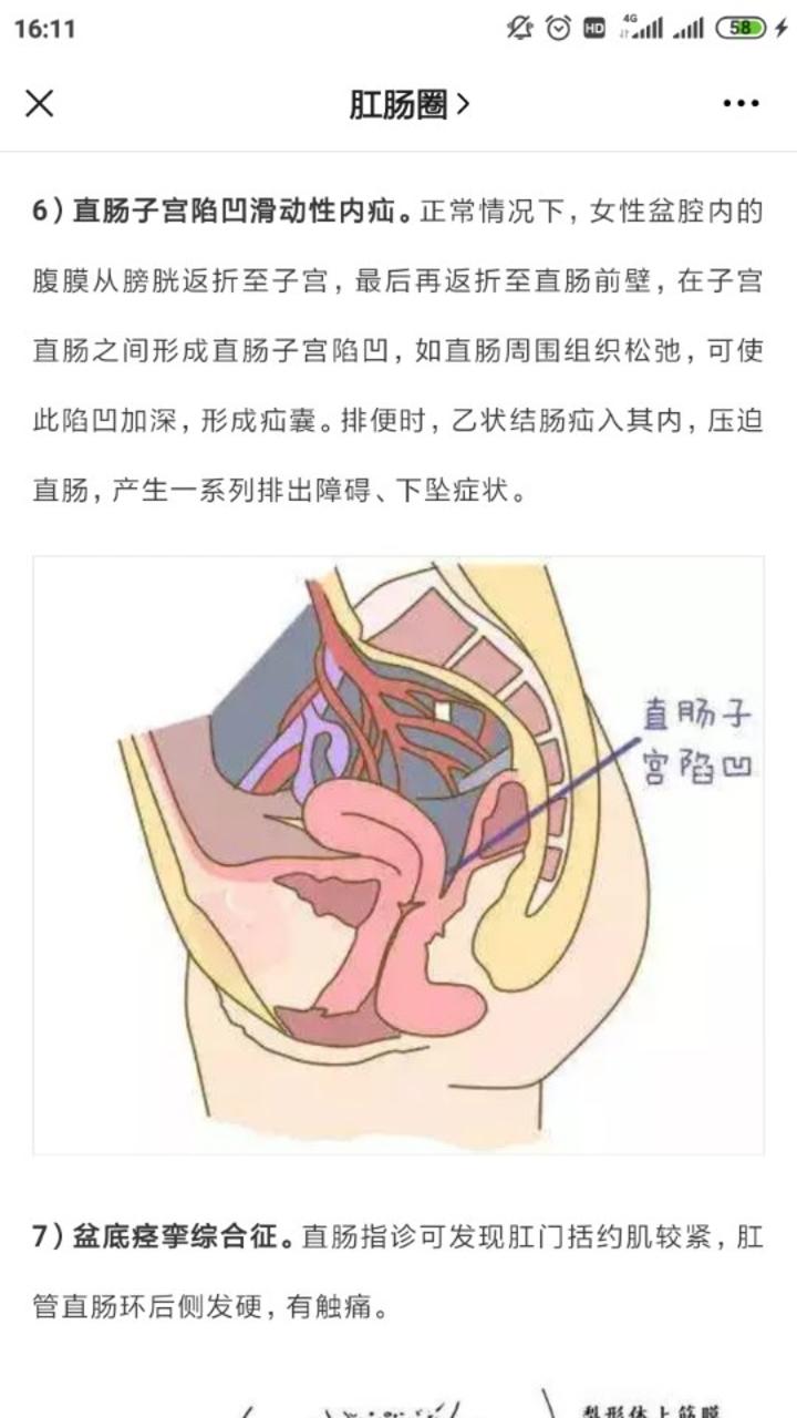 为什么便秘也会重女轻男