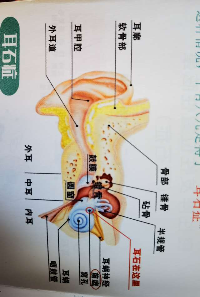 耳石症能自愈吗?图片