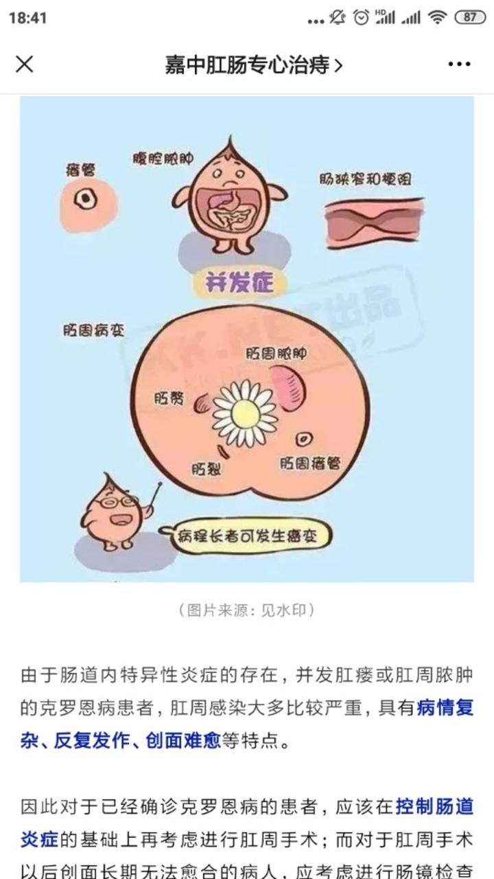 初识篇肠道小恶魔克罗恩病
