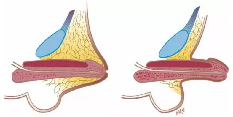 六一特辑小男孩的小弟弟