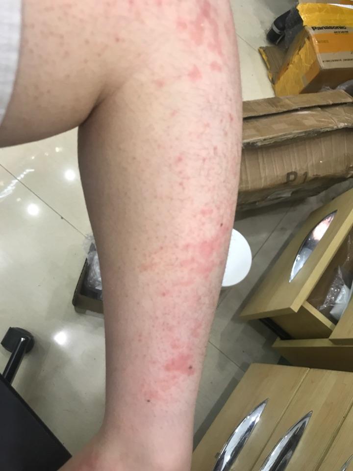 线状苔藓吗