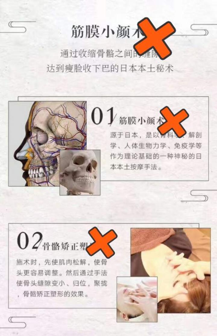 90目前想改善颧骨下颌骨突出,最有效的办法就是面部轮廓整形术.