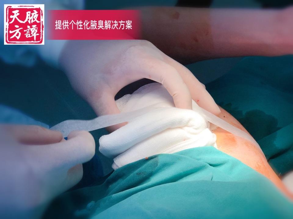 腋臭手术后是必须行创面加压包扎的,因为该手术相当于在原来的腋窝