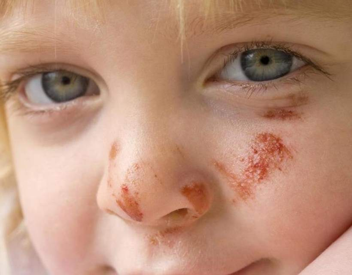 注意了:儿童磕碰伤家庭紧急处理方法都在这了!